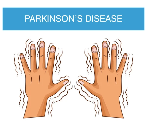 Parkinson hastalığı çizgi film