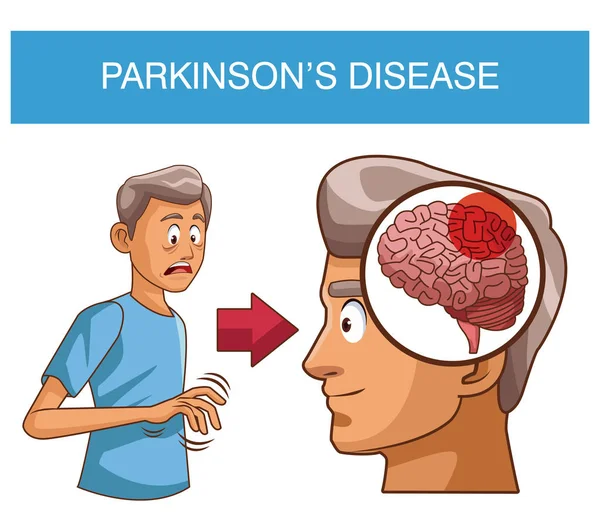 Desenhos animados da doença de Parkinsons — Vetor de Stock