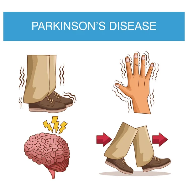 Infografía de la enfermedad de Parkinsons — Archivo Imágenes Vectoriales