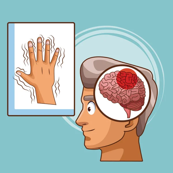 Desenhos animados da doença de Parkinsons —  Vetores de Stock