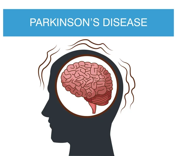 Parkinsons enfermedad de dibujos animados — Vector de stock