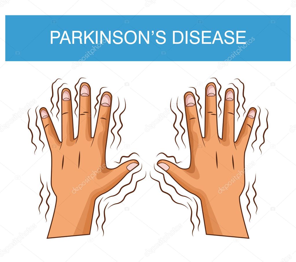 Parkinsons disease cartoon