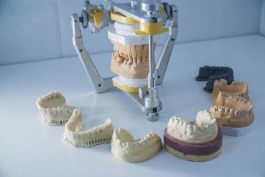 Diş yayınları bir dizi