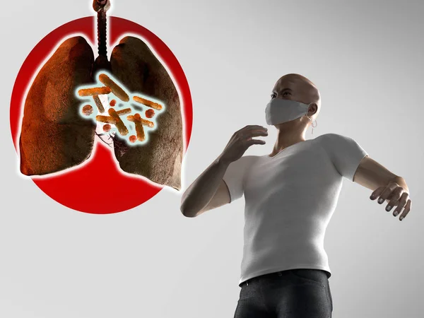 pneumonia China coronavirus concept, 3d render
