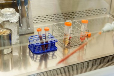 Plastik tüpteki kan örneğini kapat.