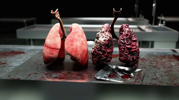 Healthy lungs and disease lungs on morgue table. Autopsy medical concept. Cancer and smoking problem. — Stock Photo, Image