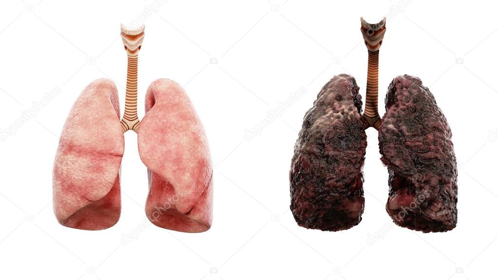 healthy lungs and disease lungs on white isolate. Autopsy medical concept. Cancer and smoking problem.