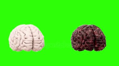 sağlıklı beyin ve hastalık beyin yeşil ekran üzerinde döndürün. Otopsi tıbbi kavramı. Kanser ve sigara sorunu.