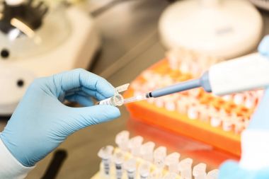 Kimyasal örnek şişe. Santrifüj. Bir test tüpüne şişe analiz için ayarlar.