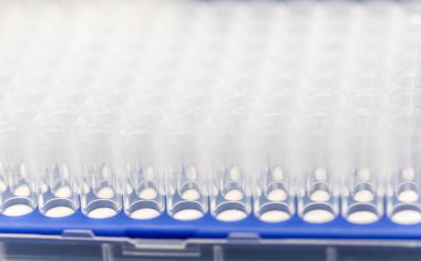 Cam tüpler örnekleri için kümesi. Laboratuvar kimyasal donatımı.