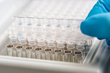 Cam tüpler örnekleri için kümesi. Laboratuvar kimyasal donatımı.