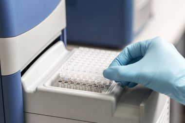 Cam tüpler örnekleri için kümesi. Laboratuvar kimyasal donatımı.