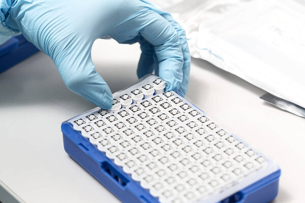 A chemical sample bottle. Centrifuge. A test tube vial sets for analysis.