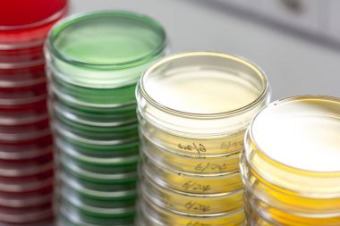 Laboratuvar masaya Petry yemekleri