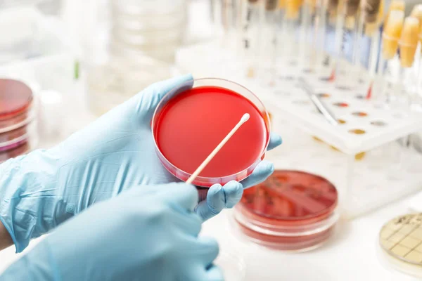 Técnico de laboratorio plantando a mano una placa de Petri —  Fotos de Stock