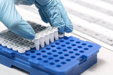 Kimyasal örnek şişe. Santrifüj. Bir test tüpüne şişe analiz için ayarlar.