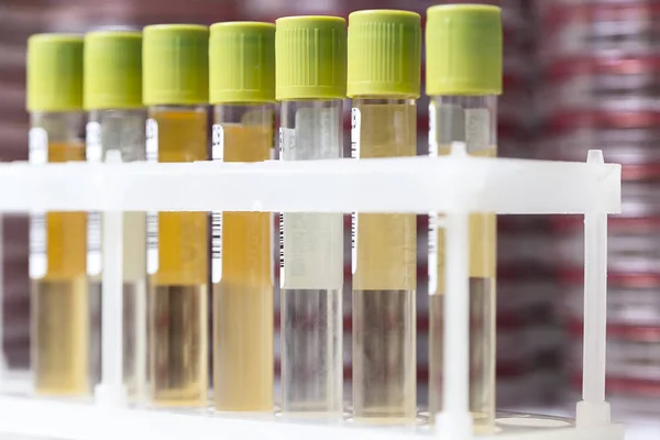 Provrör med gul vätska i laboratoriet — Stockfoto