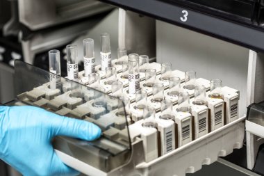 Kimyasal örnek şişe. Santrifüj. Bir test tüpüne şişe analiz için ayarlar.