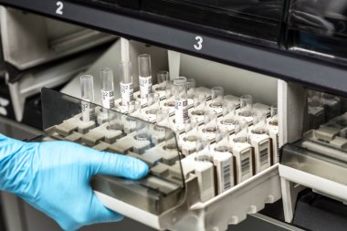 Kimyasal örnek şişe. Santrifüj. Bir test tüpüne şişe analiz için ayarlar.