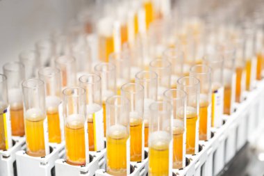 Laboratuvarda test tüpleri araştırma