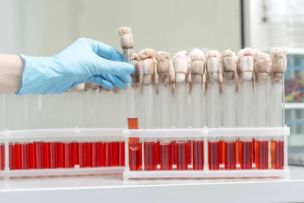 Mano de un técnico de laboratorio que sostiene la prueba del tubo sanguíneo y antecedentes un estante de tubos con muestras de sangre otros pacientes —  Fotos de Stock