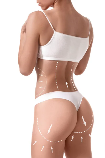 Cuerpo femenino con las flechas de dibujo en él aislado en blanco. concepto de pérdida de grasa, liposucción y eliminación de celulitis . —  Fotos de Stock