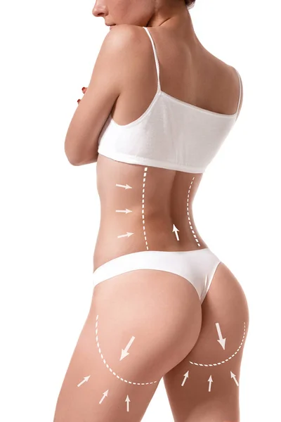 Corpo feminino com as setas de desenho sobre ele isolado em branco. Perda de gordura, lipoaspiração e conceito de remoção de celulite . — Fotografia de Stock