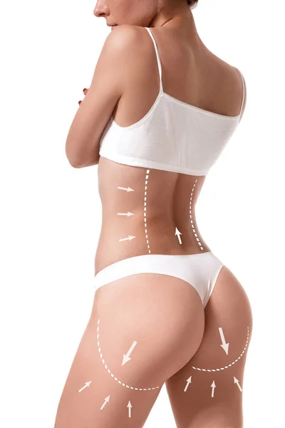 Corpo femminile con le frecce di disegno su di esso isolato su bianco. Concetto di perdita di grasso, liposuzione e rimozione della cellulite . — Foto Stock