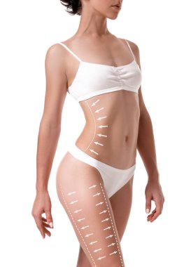 Bunun üzerine beyaz izole çizim okları ile kadın bedeni. yağ kaybetmek, liposuction ve selülit Temizleme kavramı.