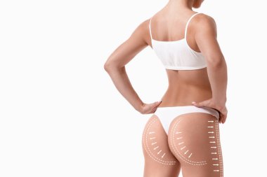 Bunun üzerine beyaz izole çizim okları ile kadın bedeni. yağ kaybetmek, liposuction ve selülit Temizleme kavramı.