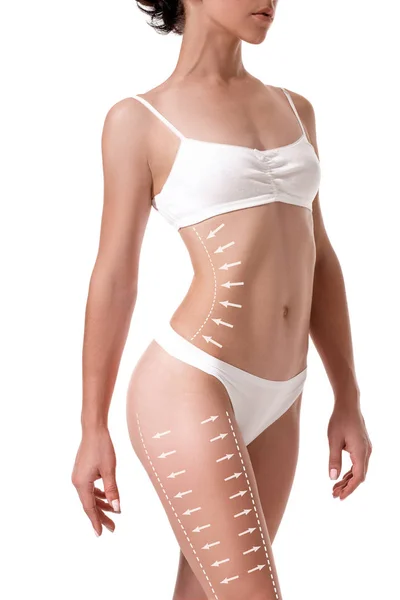 Kvinnliga kroppen med ritning pilarna på det isolerade på vitt. förlora fett, fettsugning och celluliter bort koncept. — Stockfoto