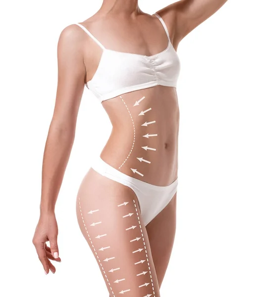 Corpo feminino com as setas de desenho sobre ele isolado em branco. Perda de gordura, lipoaspiração e conceito de remoção de celulite . — Fotografia de Stock