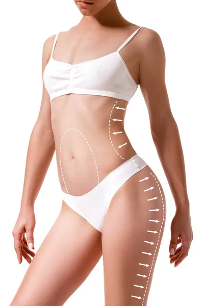 Γυναικείο σώμα με τα σχεδίασης βέλη σε αυτό απομονωθεί σε λευκό. χάνουν λίπος, λιποαναρρόφηση και κυτταρίτιδας αφαίρεση έννοια. — Φωτογραφία Αρχείου