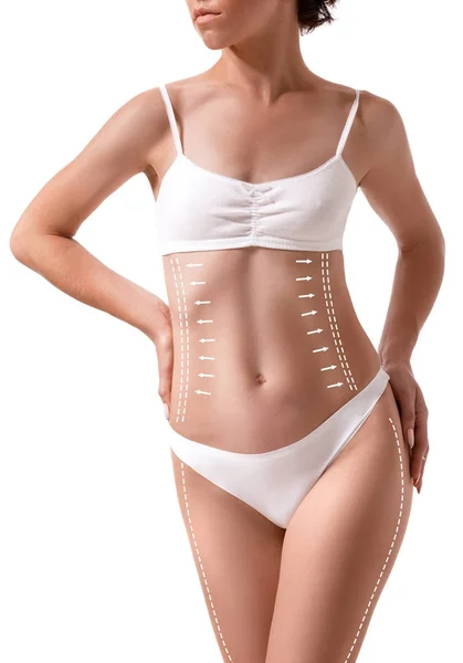 Cuerpo femenino con las flechas de dibujo en él aislado en blanco. concepto de pérdida de grasa, liposucción y eliminación de celulitis . — Foto de Stock