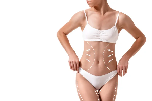 Cuerpo femenino con las flechas de dibujo en él aislado en blanco. concepto de pérdida de grasa, liposucción y eliminación de celulitis . —  Fotos de Stock