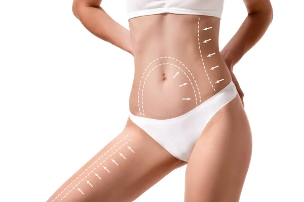 उस पर ड्राइंग तीरों के साथ महिला शरीर सफेद पर अलग। वसा खोना, liposuction और सेल्युलाईट हटाने की अवधारणा . — स्टॉक फ़ोटो, इमेज