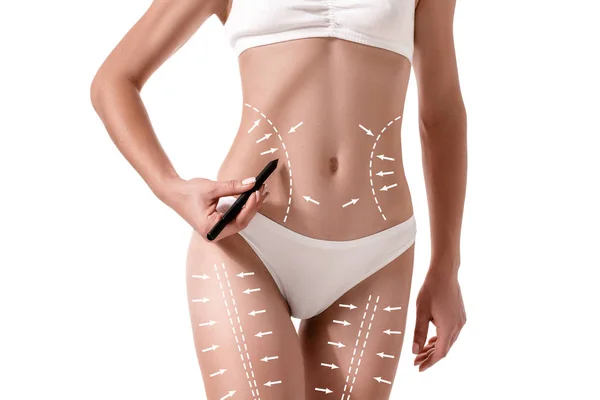 Frauenkörper mit den Zeichnungspfeilen darauf isoliert auf weiß. Fettabbau, Fettabsaugung und Celluliteentfernung. — Stockfoto