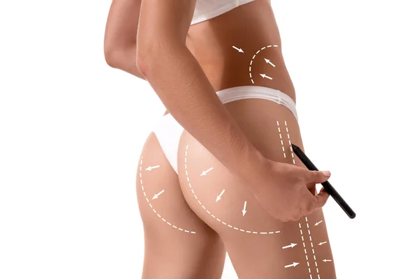 女性の身体は、白で隔離されるそれを図面の矢印と。脂肪を失う、脂肪吸引・ セルライト除去の概念. — ストック写真
