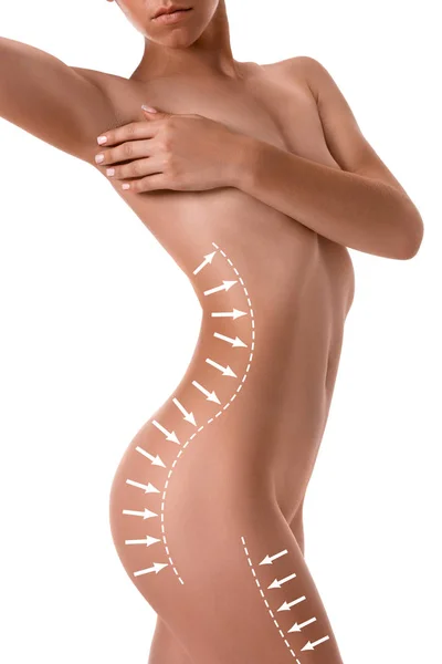 Cuerpo femenino con las flechas de dibujo en él aislado en blanco. concepto de pérdida de grasa, liposucción y eliminación de celulitis . —  Fotos de Stock