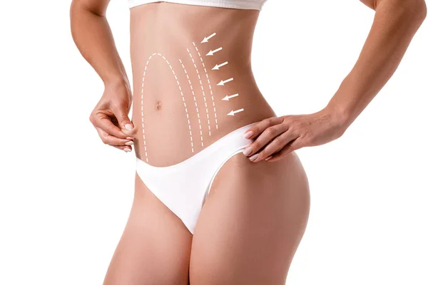 Vrouwelijk lichaam met de tekening pijlen op het geïsoleerd op wit. vet verliezen, liposuctie en cellulitis verwijdering concept. — Stockfoto