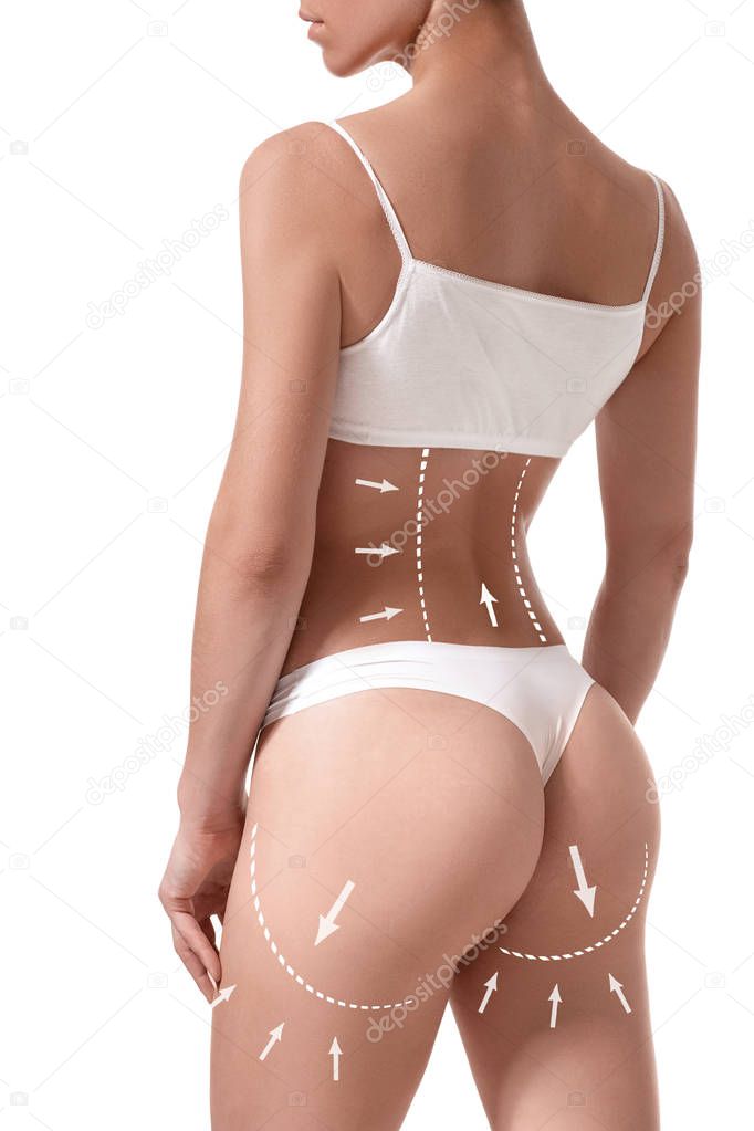 Female body with the drawing arrows on it isolated on white. Fat lose, liposuction and cellulite removal concept.