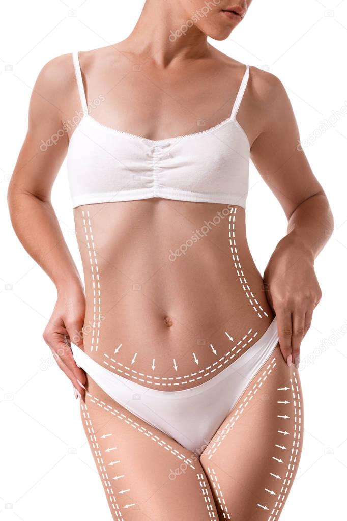 Female body with the drawing arrows on it isolated on white. Fat lose, liposuction and cellulite removal concept.