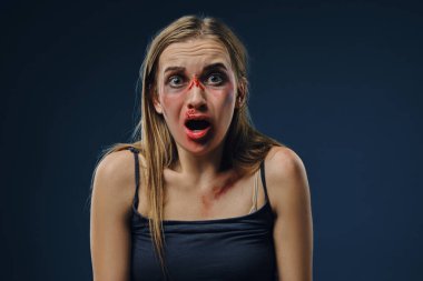 Siyah tişörtlü, paniklemiş sarışın kadın. Yüzü morluklarla kaplıydı, korkmuş görünüyordu, mavi arka planda oturuyordu. Yakın plan.