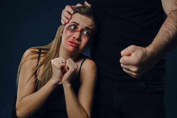 Cruel male put his hand on woman head. Scared victim with bruises on face sitting nearby, terrified. Blue background. Domestic violence. Close-up