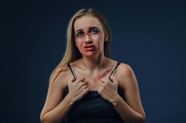 Girl with bruises on her face and chest holds on to her black t-shirt, posing sitting against blue studio background. Domestic violence. Close-up