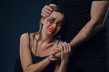 Man put his hand on female head, like hugging. They holding hands. Victim with bruises sitting nearby. Blue background. Domestic violence. Close-up.