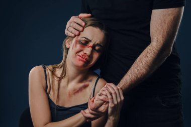 Man put his hand on female head, like hugging. They holding hands. Victim with bruises sitting nearby. Blue background. Domestic violence. Close-up.