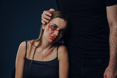 Strong man put his hand on female head, like hugging. Scared victim with bruises on face sitting nearby. Blue background. Domestic violence. Close-up