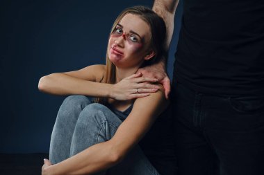 Strong man put his hand on female shoulder. Scared victim with bruises on face sitting nearby. Blue background. Domestic violence, abuse. Close-up.