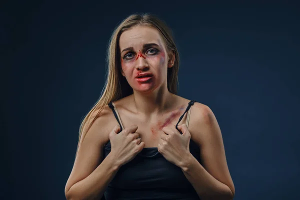 Girl with bruises on her face and chest holds on to her black t-shirt, posing sitting against blue studio background. Domestic violence. Close-up — ストック写真